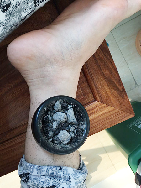 艾灸盒什么材質的好?什么樣的好用?
