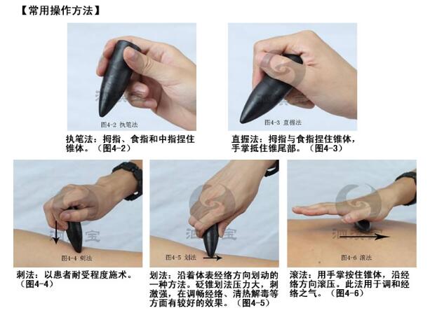 砭石的用法復(fù)雜嗎,不懂穴位能不能用?
